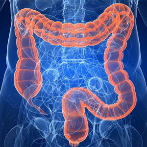 Retocolite Ulcerativa Inespecífica